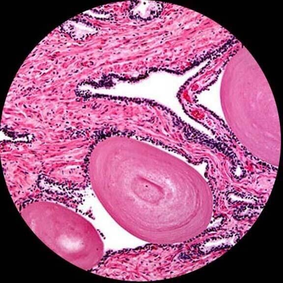 Amscope M620 Series Monocular LED Compound Microscope 40X-2500X Magnification with 1.0MP Digital Camera